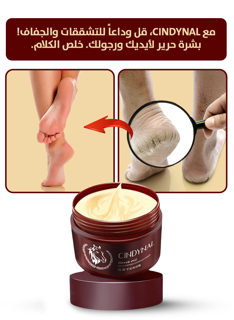 كريم Cinydal الأصلي للتخلص من تقفشات القدم فوراً 💖
